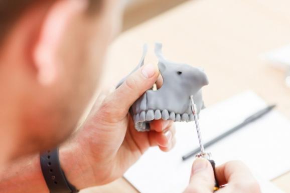 Mini-vis orthodontiques Mini-vis orthodontiques