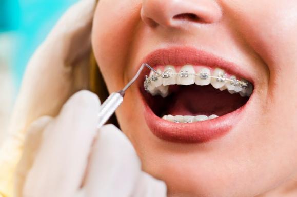 soins orthodontiques soins orthodontiques