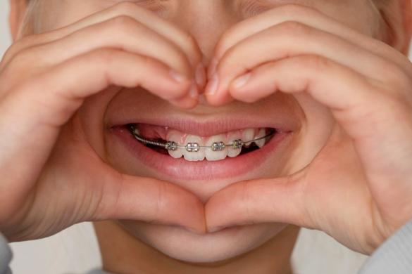traitement orthodontique précoce traitement orthodontique précoce